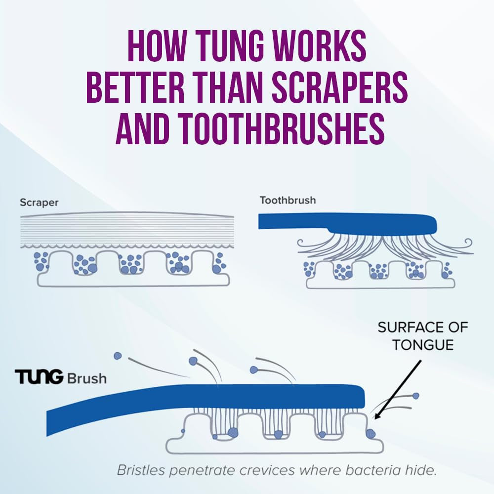Tung Tongue Cleaning Kit, Tung Brush and Gel, Bad Breath Odor Eliminator, Halitosis Defense, USA Made (Set of 1)