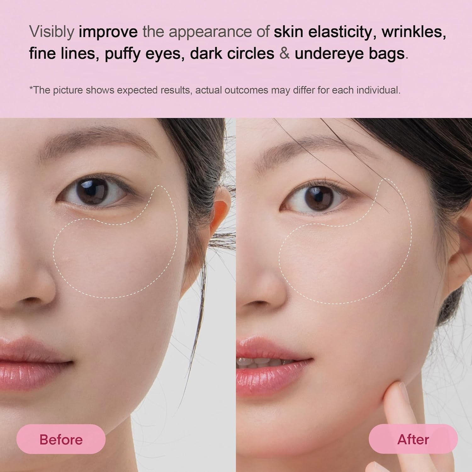 Peptide Collagen under Eye Patches - 60 Korean Firming, Glowing & Hydrating Hydrogel Mask for Puffy Eyes, Dark Circles, Wrinkles, Fine Lines, Undereye Bags - Anti-Aging Eye Gel Pads
