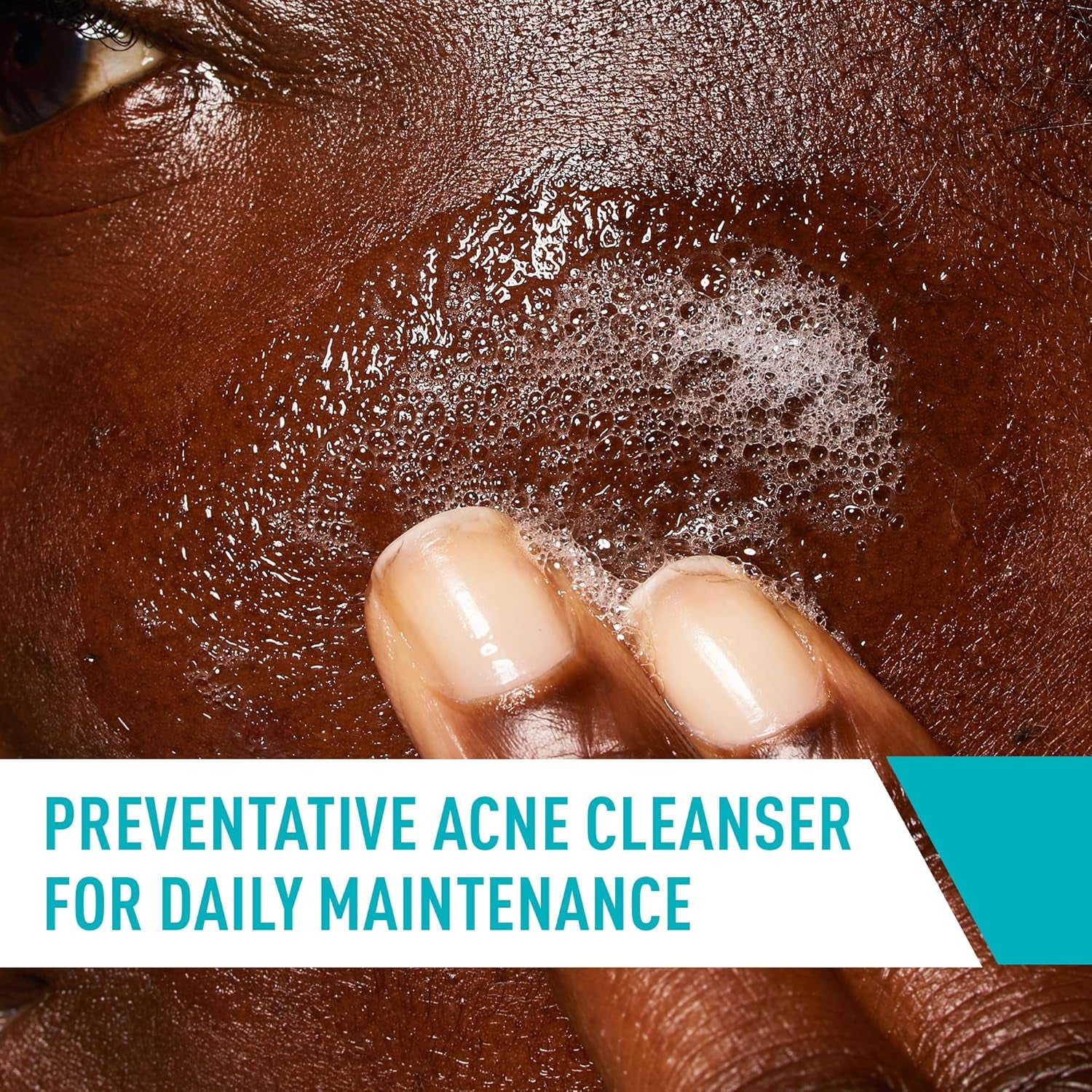 Acne Control Cleanser, 2% Salicylic Acid Treatment Formulated with Niacinamide + Ceramides + Oil Absorbing Clay, Gentle Face Wash Helps Clear & Prevent Acne, Fragrance Free, 16 Ounce