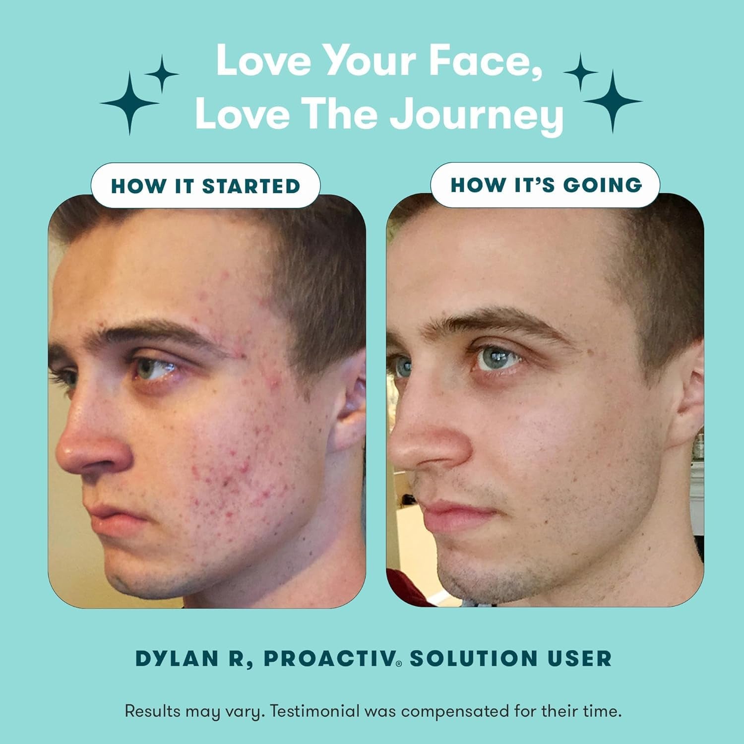 3 Step Acne Treatment W/ Pimple Patches - Benzoyl Peroxide Face Wash, Repairing Acne Spot Treatment for Face and Body, Exfoliating Toner - 90 Day Complete Acne Skin Care Kit + Pimple Patches